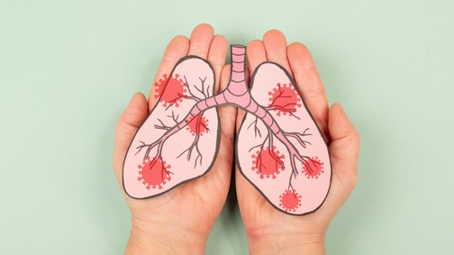 A tüdőrák 6 jele, amit minden embernek ismernie kellene