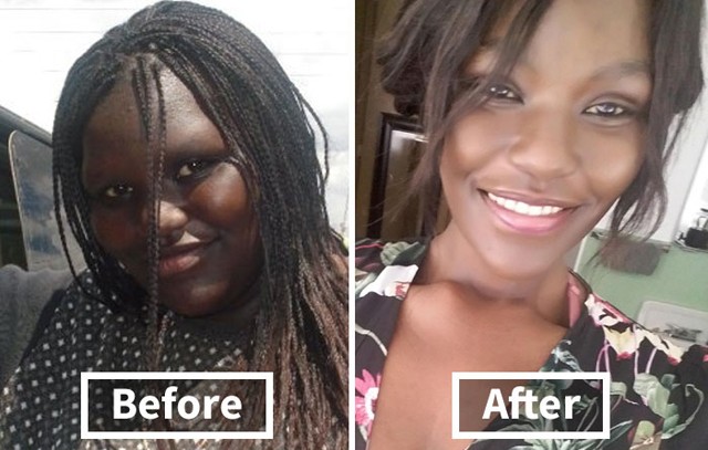 Így változik az ember arca a fogyástól! *Megdöbbentő előtte-utána fotók!*