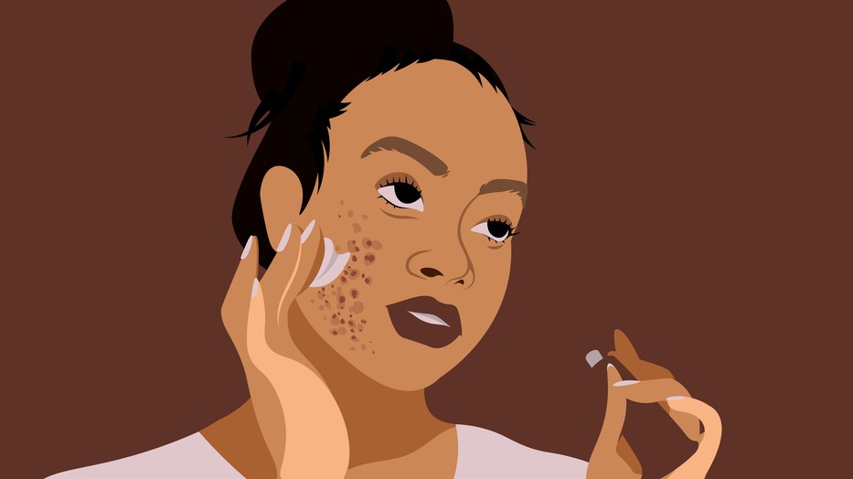 Pattanás, amit soha nem szabad kinyomni!