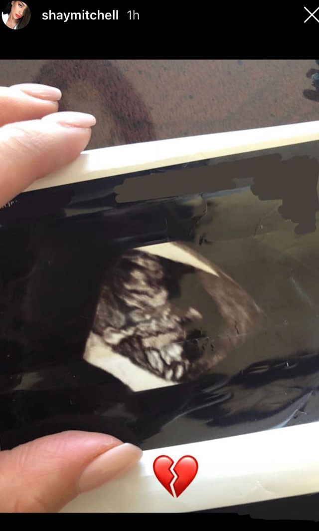 A Pretty Little Liars sztárja szörnyű bejelentéssel kezdte az évet