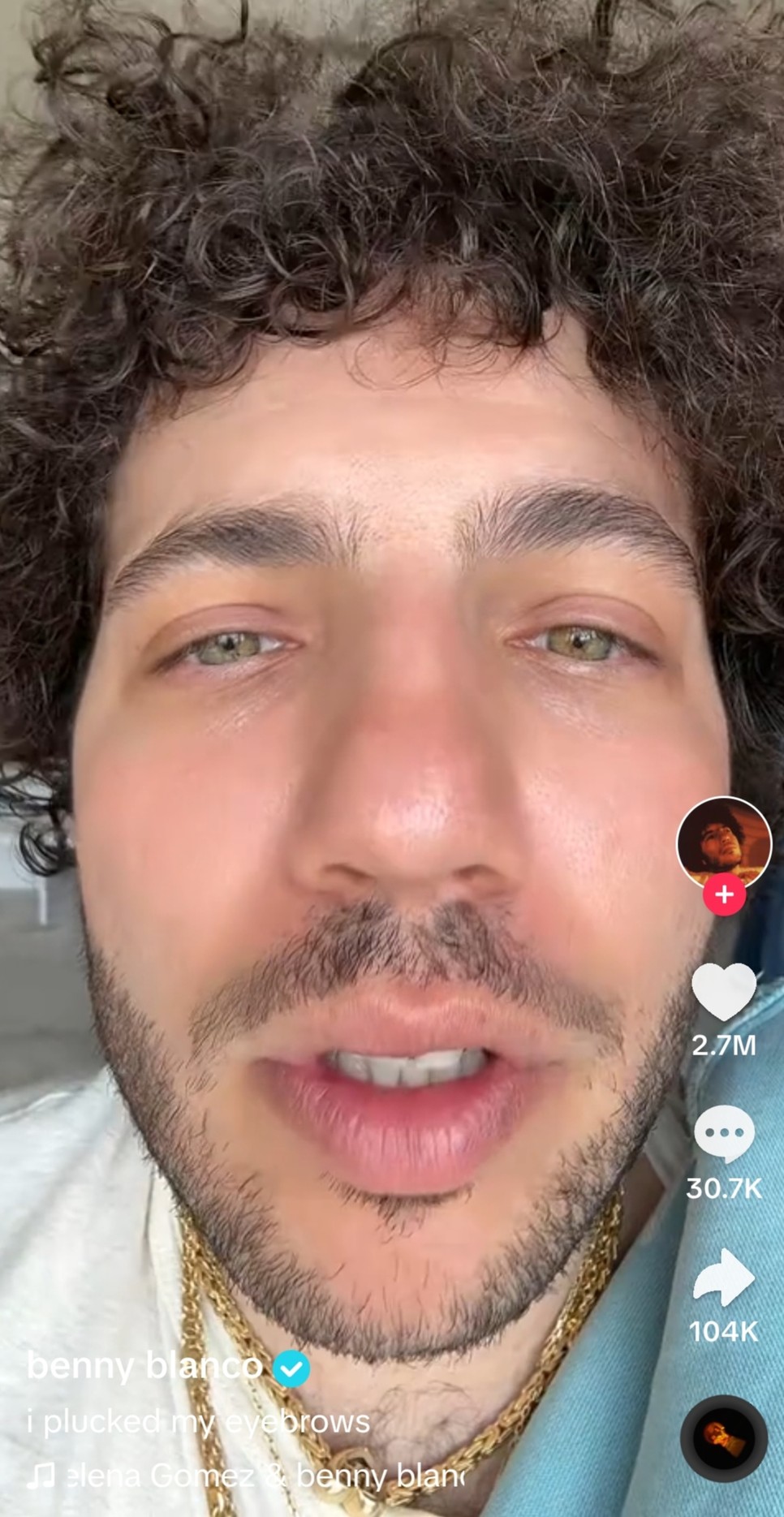 Benny Blanco kiszedette szemöldökét