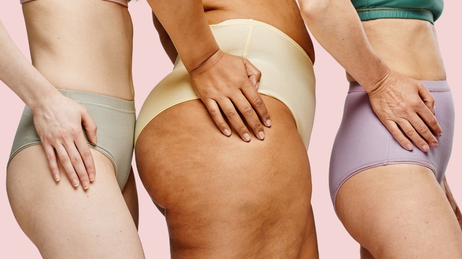 A fenéken megjelenő pattanások zavaróak tudnak lenni, de könnyen lehet tenni ellenük