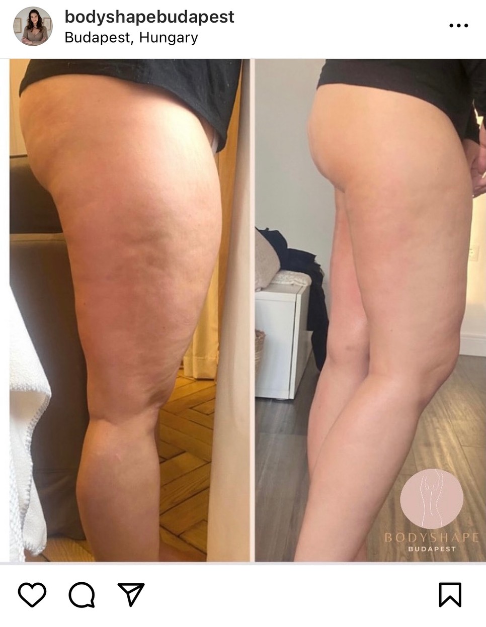 Tónusosabb lábak, kerekebb popsi és viszlát narancsbőr!