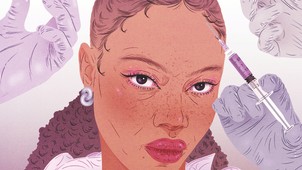 Hatékony és korszerű megoldás hajhullás ellen - ismerd meg a fejbőr injekciózás hatásait