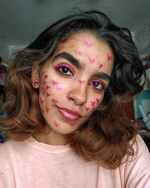 Pattanások az arc különböző részein: ilyen betegségekre utalhatnak