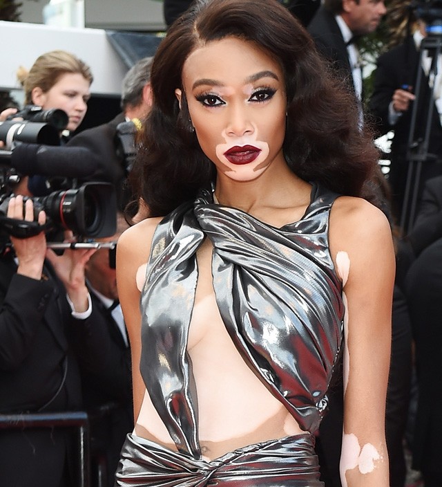 Winnie Harlow