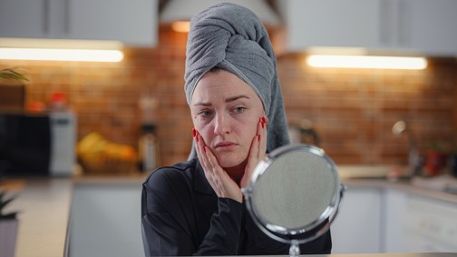 Ezt teszi a stressz a bőröddel - 5 tipp, hogy elfelejtsd a stressz okozta bőrproblémákat