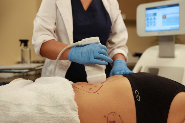 Végleges zsíreltávolítás vágás nélkül