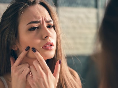 Visszatérő pattanások az arcon - ezzel az aprósággal ártasz a bőrödnek nap mint nap