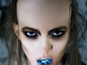 Kopaszon, zárt osztályon a magyar modell