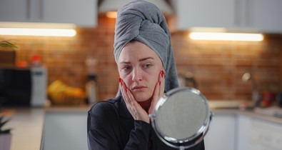 Ezt teszi a stressz a bőröddel - 5 tipp, hogy elfelejtsd a stressz okozta bőrproblémákat