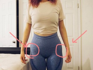 Csípő bemélyedés az új Insta-trend!