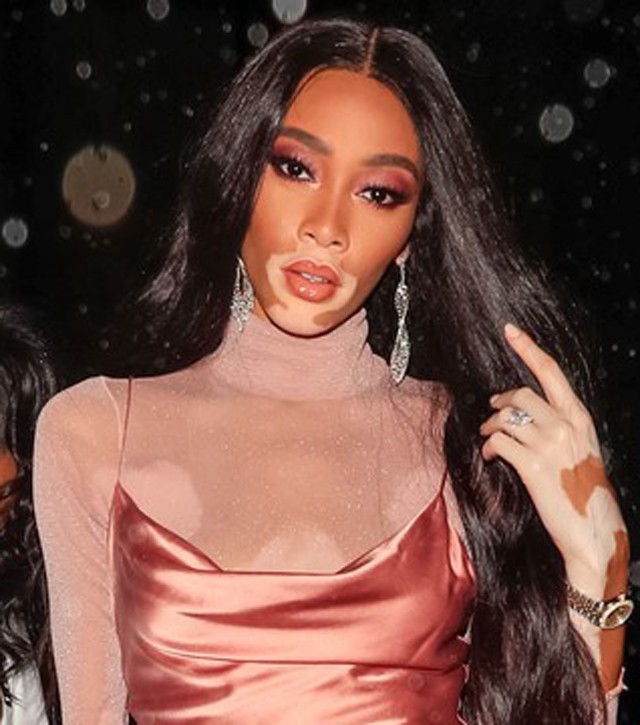 18+ Winnie Harlow ruhája leesett a fotósok kereszttüzében és mindent megmutatott