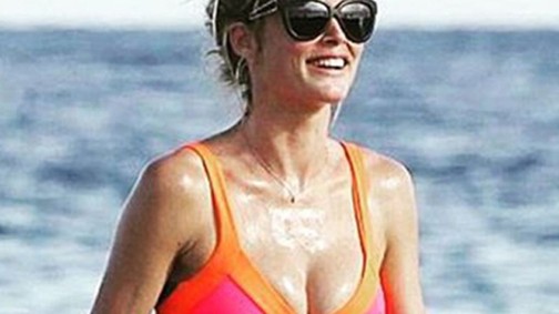 Atyaég! Doutzen Kroes kockás hasa már túlzás