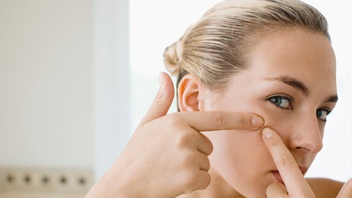 Íme egy mitesszergyilkos páros, ha meguntad a fekete pöttyöket