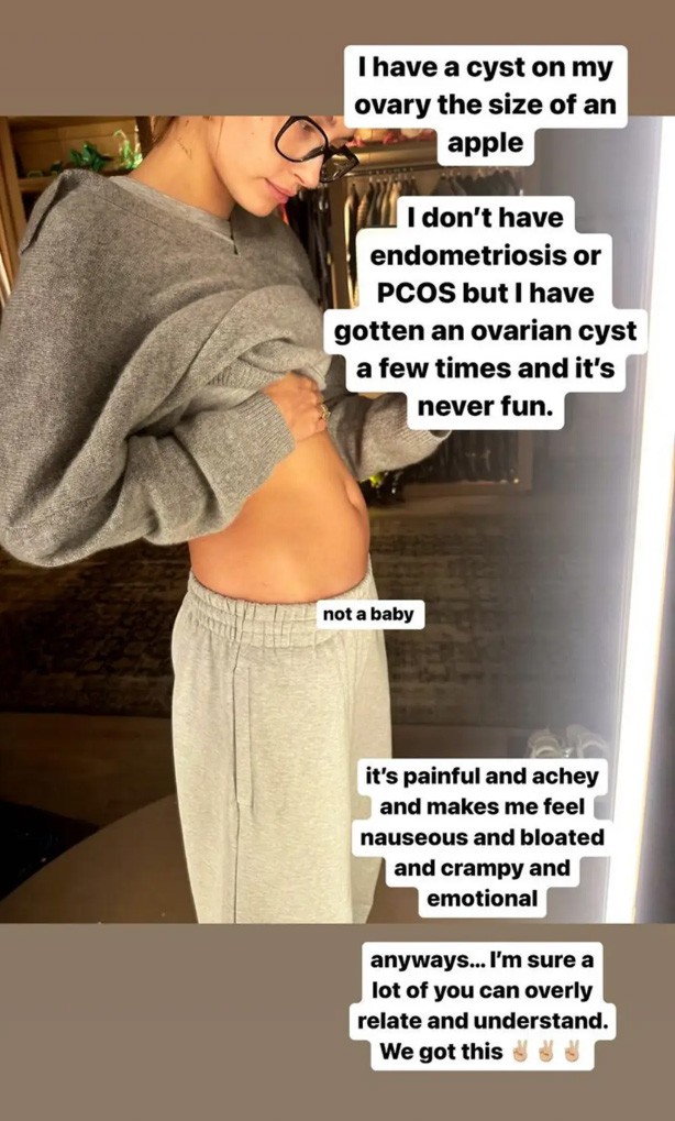 Hailey Bieber egy Instagram sztoriban nyílt meg az alma méretű petefészek cisztájával való küzdelméről | @haileybieber