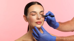 Járványszerűen terjed az orrplasztika, de még mindig nem jó indokkal fekszünk a szike alá