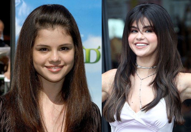 Selena Gomez is a gyermeksztárok sorát erősítette. A gyönyörű arc mögött azonban tragikus betegség bújik meg, hiszen az énekesnő évek óta lupusszal küzd, ami miatt veseátültetésen is át kellett esnie. A betegség és depresszió miatt Selena rengeteget változott, viszont jelenleg magabiztosabb, mint valaha.