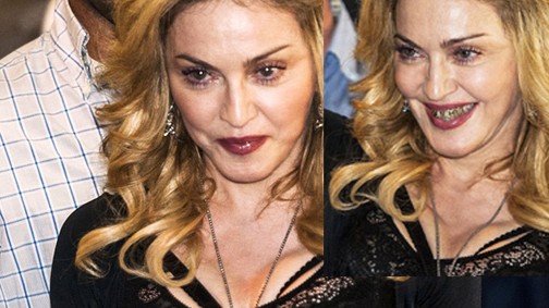 Arany fogszabályzóval riogat Madonna