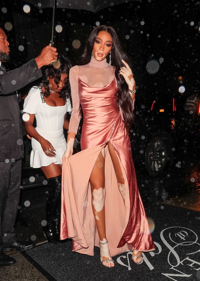 18+ Winnie Harlow ruhája leesett a fotósok kereszttüzében és mindent megmutatott