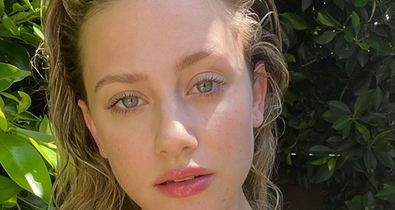 Ezért használj napozás utáni testápolót