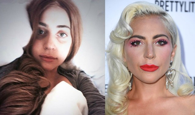 Sztárok, akik szinte felismerhetetlenek smink nélkül