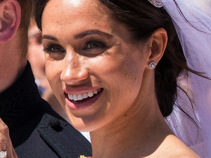 Neked is lehet olyan ragyogó bőröd az esküvődön, mint Meghan Markle-nek, ez az okos kis eszköz kell csak hozzá