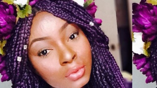 Ennek a lánynak teljesen összeégett az arca, de úgy megtanult sminkelni, hogy nem hiszed el, amit látsz!