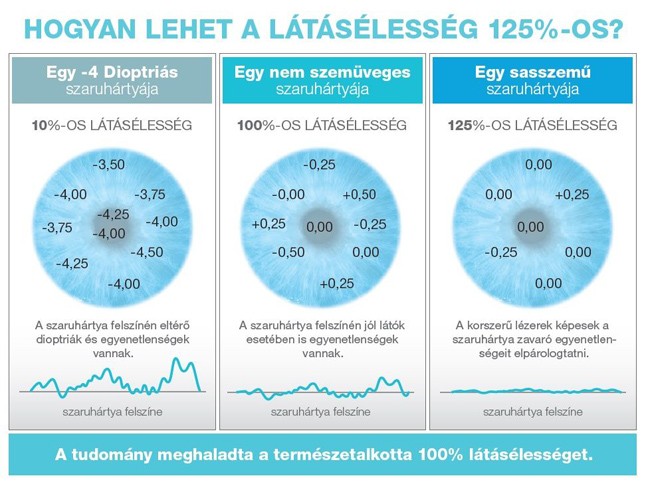 Hogyan lehet a látásélesség 125%-os?
