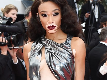 Winnie Harlow olyan erotikus fenékrázást nyomott, hogy csoda, hogy nem tiltotta le az Instagram