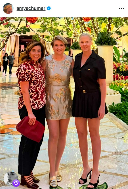 Amy Schumer lábai egyszerűen észbontóak