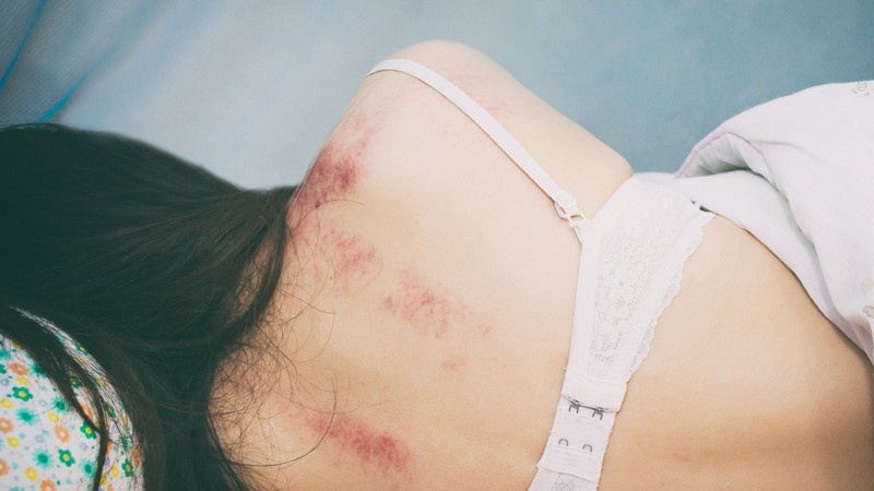 A tudás, ami életmentő lehet: így tudnak segítséget kérni a kapcsolati erőszak áldozatai Magyarországon