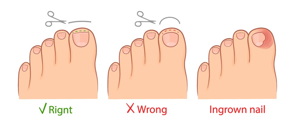 Sokszor a helytelen kezelés még nagyobb problémákat szül