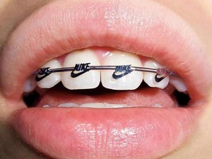 Megtanítunk: így kell kiejteni a világmárkák nevét