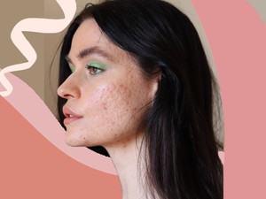 9 példamutató influenszer, aki elfogadja bőrét úgy, ahogy van