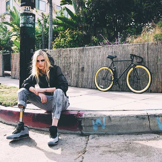 lauren wasser, műláb, műlábú modell, toxikus sokk, tss