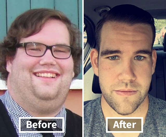 Így változik az ember arca a fogyástól! *Megdöbbentő előtte-utána fotók!*