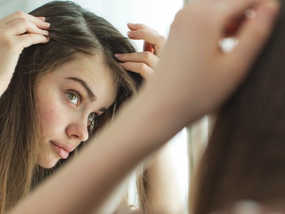 Ennek az egy terméknek a segítségével búcsút mondhatsz a korpás fejbőrnek!