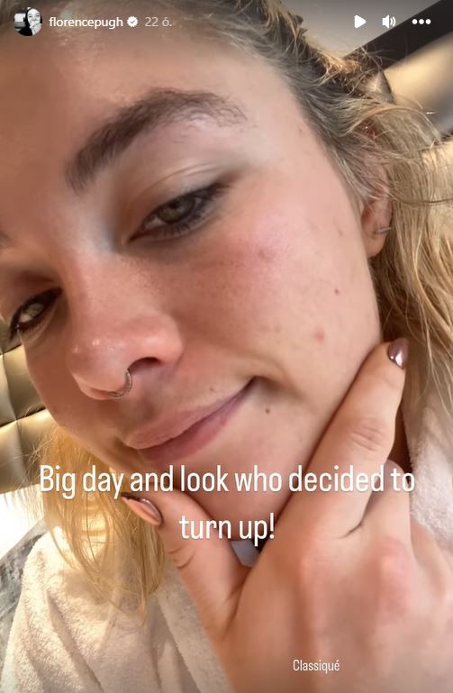 Florence Pugh mindig büszkén vállalja önmagát