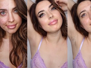 Az influenszer, aki a filterek korában is felvállalja a szőrzetét és a pattanásait - és nem kér érte elnézést