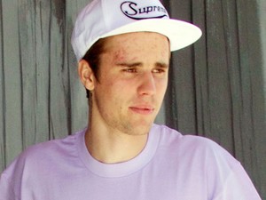 Egyre extrémebb: Justin Bieber fogékszert és új piercinget csináltatott