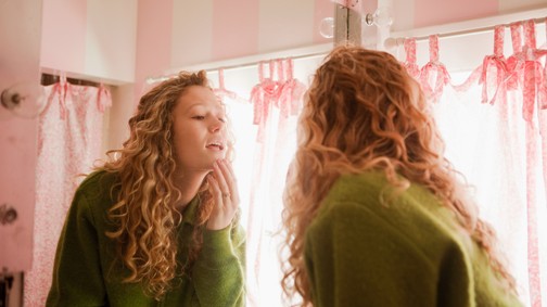 Vigyázz, mert ez az 5 étel bőrproblémákat okozhat