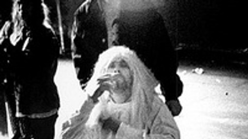 Lady Gaga kerekesszékbe került