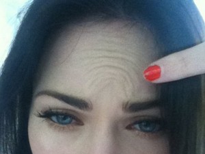 Megan Fox: Nincs botox!