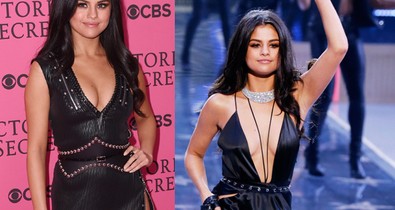 Selena Gomez, mi lett a szemeddel?