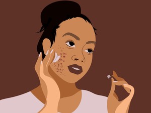 Fogkrémet pattanásra? Ha nem szeretnéd tönkretenni a bőrödet, inkább ne trükközz ezzel