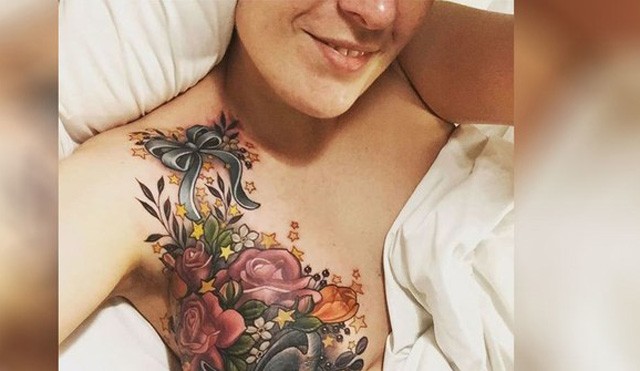 tetoválás, mellrák, emlőrák, rák, lumpectomia, melleltávolítás, mellbimbó, alison habbal