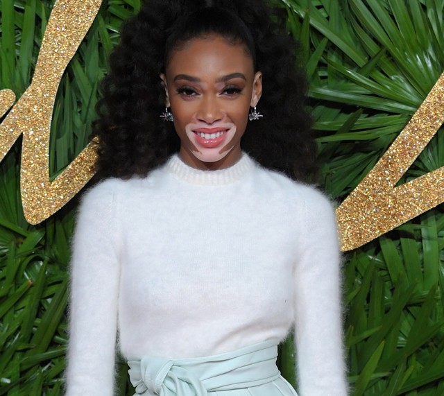 Winnie Harlow a tél királynője ebben a ruhában!