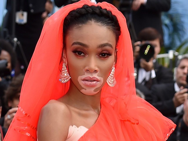 Winnie Harlow akkorát villantott, hogy oda sem merünk nézni, de még így is látjuk...