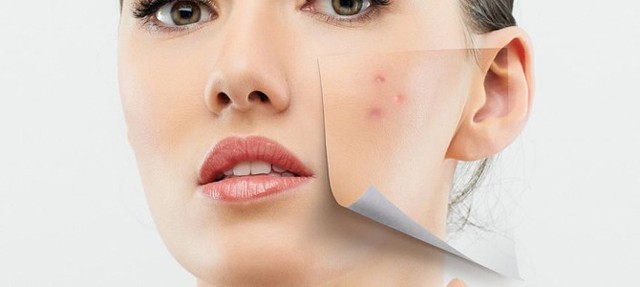 Problémás a bőröd? Tegyél ellene tudatosan!